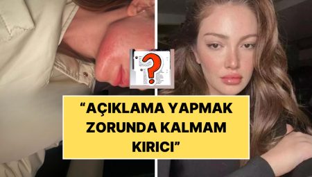 Danla Bilic Yara İzini Sorgulayan Kullanıcıya Karşılık Verdi