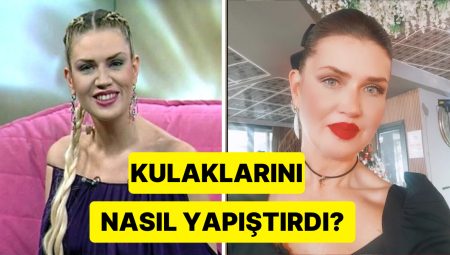 Eski Model Tabiat Bekleriz’in Kepçe Kulaklarını Yapıştırma Olayının Farklı Ayrıntıları