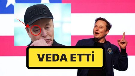 Donald Trump, Elon Musk’a Veda Etti: Elon Musk’ın Morarmış Gözü Dikkat Çekti