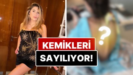 Kemikleri Sayılıyor: 29 Kiloya Düşen ve Organ Yetmezliği Teşhisi Konulan Nihal Candan’ın Bedeninin Son Hali!