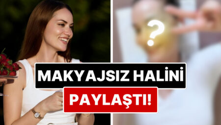 Doğal Yüzü Dikkat Çekti: Estetik Savlarını Yalanlayan Fahriye Evcen Makyajsız Halini Paylaştı!
