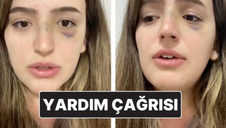 Eşinden Şiddet Gören Bayanın Yardım Daveti: “Lütfen Sesim Olun”