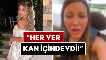 Gözyaşları İçinde Paylaştı: Toplumsal Medya Fenomeni Mika Raun Tatil İçin Gittiği Dubai’de Otomobil Kazası Geçirdi!