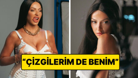 Hadise, Yüzündeki Kırışıklıklara Laf Edenlere Had Bildiren Bir Paylaşım Yaptı!