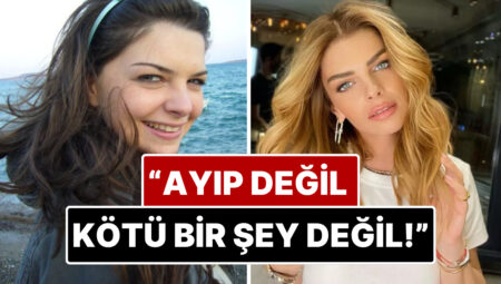 Tüm Yüzünü Yaptırdığı Söylenen Pelin Karahan Hakkındaki Estetik Tezlerine Karşılık Verdi!
