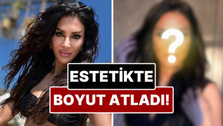Yok Bu türlü Estetik: Hoşluk Merkezleri Sahibi Emsal Doğan Geçirdiği Operasyonla Gözlerinin Rengini Değiştirdi!