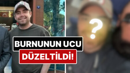 11 Defa Ameliyat Geçiren Murat Dalkılıç’ın Burnunun Ucu Estetik Müdahalelerle Düzeltildi!