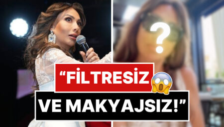 6 Ayda 25 Kilo Vermişti: 36 Vücuda Düşmesine Karşın Photoshop’u Bırakmayan Işın Karaca Doğal Halini Paylaştı!