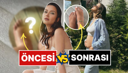 7 Aylık Gebe İrem Helvacıoğlu Hamilelikte Ödemden Kocaman Olan Ayaklarının Dermanını Bakın Ne ile Buldu?