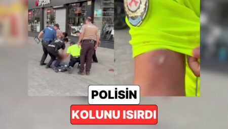 Aydın’da Kimliğini Vermek İstemeyen Bir Şoför Tartışma Yaşadığı Polisin Kolunu Isırdı