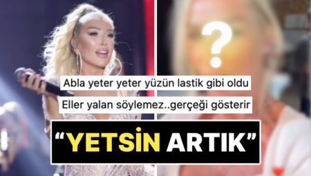 “Eller Palavra Söylemez”: Yeni Yaptırdığı Estetikle Yüzünün Kalktığına İnanan Seda Sayan Son Halini Paylaştı!