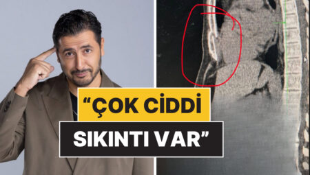 Karadağ’da Geçirdiği Kazada Göğüs Kemiği Kırılan Taner Çağlı Sıhhat Sistemine Reaksiyon Gösterdi