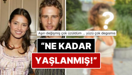 Sabrı Taştı: Oyuncu Irmak Erdoğan Son Haline Gelen “Ne Kadar Yaşlanmış” Yorumlarını Yanıtsız Bırakmadı!