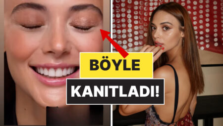 Sonunda Çıldırttılar: Rabia Soytürk, Estetik Tezlerine Ateş Püskürdü!